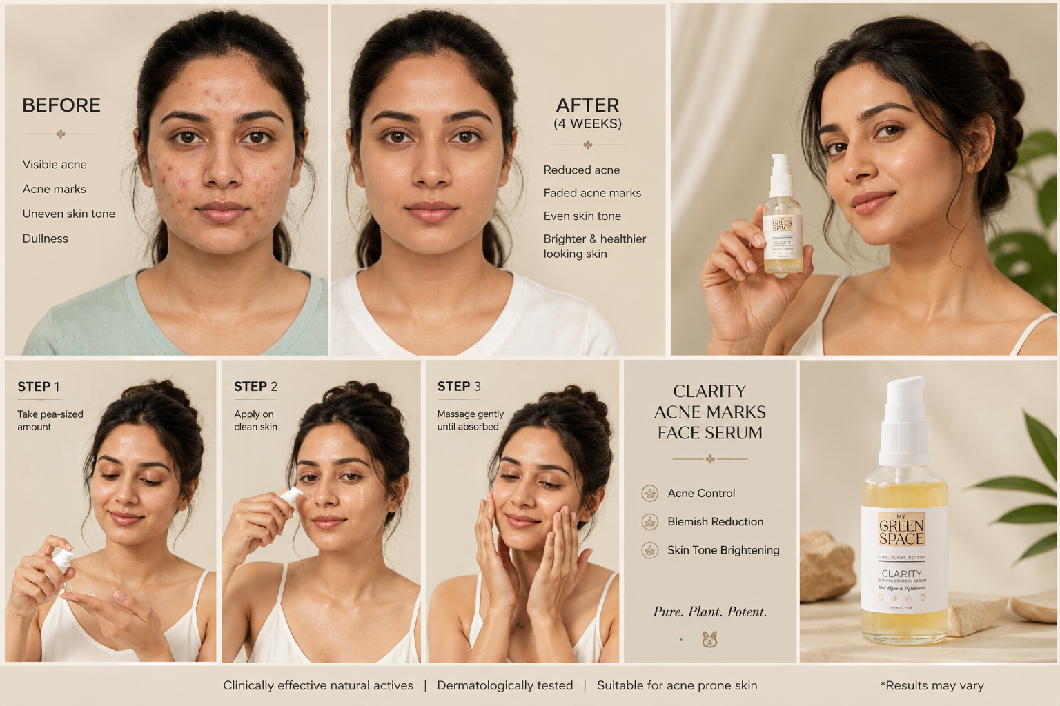 Clarity Acne Marks Face Serum
